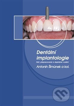 Dentální implantologie - Antonín Šimůnek, Artilis, 2020