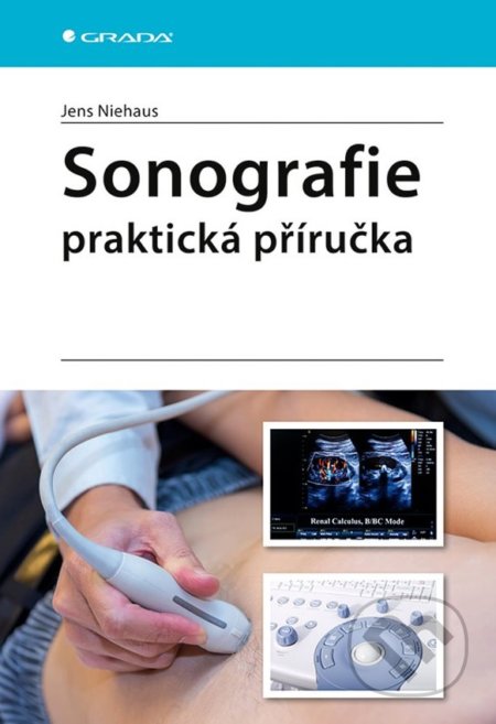 Sonografie (Praktická příručka) - Jens Niehaus - kniha z kategorie Medicína