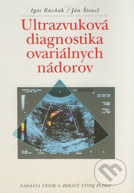 Ultrazvuková diagnostika ovariálnych nádorov - Igor Rusňák, Ján Štencl, Nadácia vznik a zdravý vývoj plodu, 1995