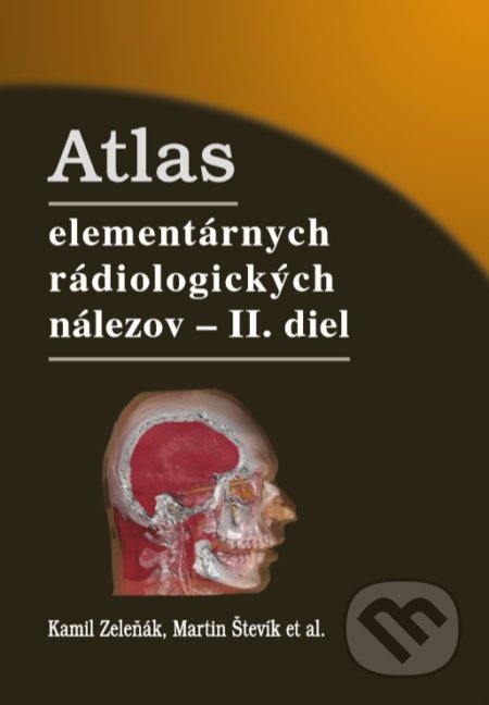 Atlas elementárnych rádiologických nálezov - II. diel - Kamil Zeleňák, Martin Števík a kolektív, Tlačiareň P+M, 2020