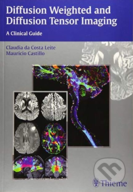Diffusion Weighted and Diffusion Tensor Imaging - Claudia Leite, Mauricio Castillo, Thieme, 2016