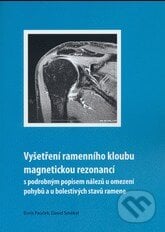 Vyšetření ramenního kloubu magnetickou rezonancí - Boris Pauček, David Smékal, Univerzita Palackého v Olomouci, 2018