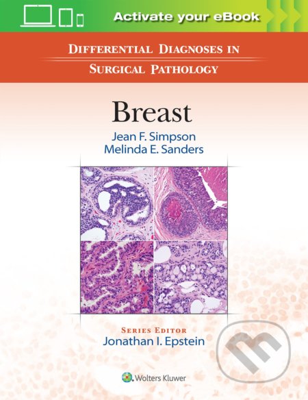 Differential Diagnoses in Surgical Pathology: Breast - Jean F. Simpson, Melinda E. Sanders, Lippincott Williams & Wilkins, 2016