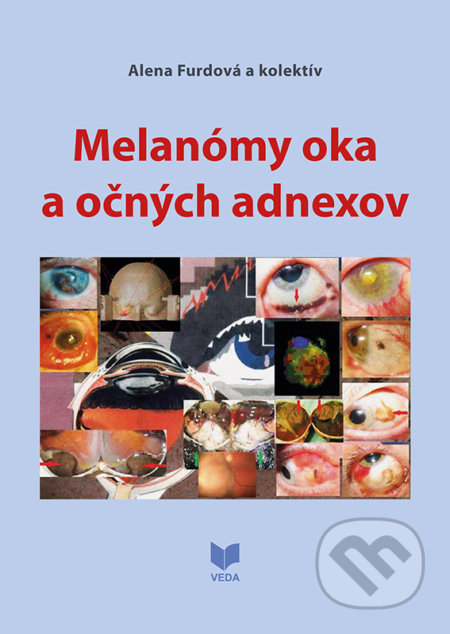 Melanómy oka a očných adnexov - Alena Furdová a kolektív, VEDA, 2020