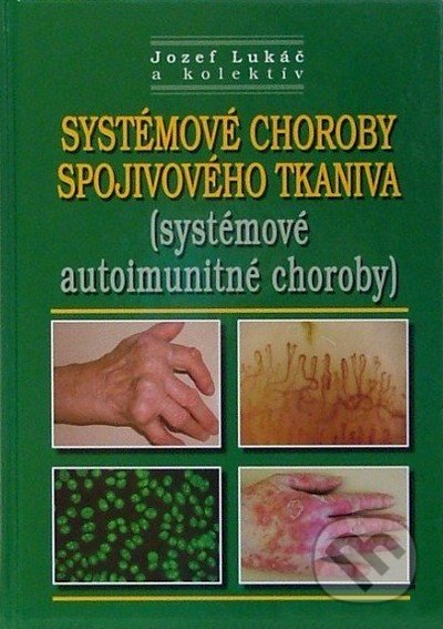 Systémové choroby spojivového tkaniva (systémové autoimunitné choroby) - Jozef Lukáč a kol., Osveta, 2010