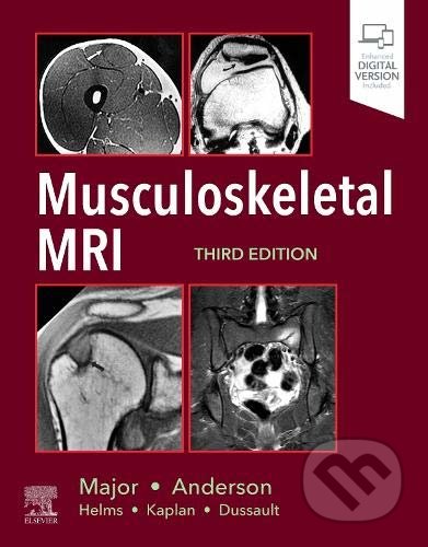 Musculoskeletal MRI - Nancy M. Major, Mark W. Anderson, Elsevier Science, 2020