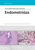 Endometrióza - Jiří Lenz, Radek Chvátal, Luděk Fiala, Grada, 2021