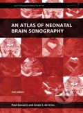 An Atlas of Neonatal Brain Sonography - Paul Govaert, Linda S. de Vries, Mac Keith Press, 2010
