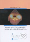 Význam PET/CT pro plánování radioterapie nádorů hlavy a krku - Iveta Kolářová a kolektív, Nucleus HK, 2011