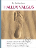 Kniha: Hallux valgus (Christian Larsen). Poznání, 2022
