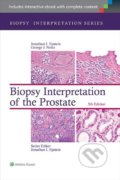 Biopsy Interpretation of the Liver - Michael Torbenson, Lippincott Williams & Wilkins, 2014