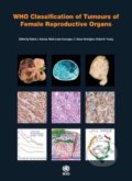 WHO Classification of Tumours of Female Reproductive Organs - Robert J. Kurman, World Health Organization, 2014
