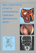Funkčná endoskopická chirurgia prinosových dutín - Marián Sičák, Osveta, 2001