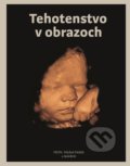 Tehotenstvo v obrazoch - Michal Holáň a kolektív, Fortuna Libri, 2018