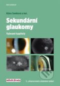 Sekundární glaukomy - Klára Samková, 2018