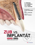 Kniha: Zub vs. implantát (Pio Bertani, Paolo Generali, Fabio Gorni a Tiziano Testori). Grada, 2025