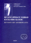 Revizní operace náhrad kyčelního kloubu - Oldřich Čech, Valér Džupa, 2004