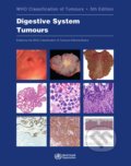 Who Classification of Tumours: Digestive System Tumours, 2019