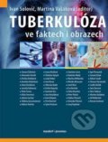 Tuberkulóza ve faktech i obrazech - Ivan Solovič, Maxdorf, 2019