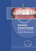 Dentální implantologie - Antonín Šimůnek, Artilis, 2020