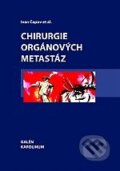 Chirurgie orgánových metastáz - Ivan Čapov a kol., Karolinum