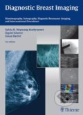 Diagnostic Breast Imaging - Sylvia H. Heywang-Koebrunner, Ingrid Schreer, Susan Barter, Thieme, 2014