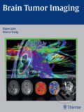 Kniha: Brain Tumor Imaging (Rajan Jain a Marco Essig). Thieme, 2015