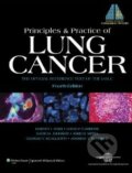 Principles and Practice of Lung Cancer: The Official Reference Text of the IASLC - Harvey I. Pass et al., Lippincott Williams & Wilkins, 2010