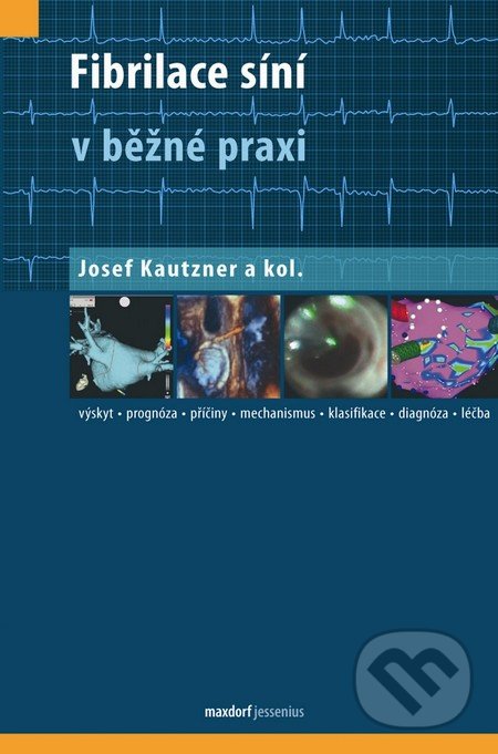 Fibrilace síní v běžné praxi - Josef Kautzner a kol., Maxdorf, 2012