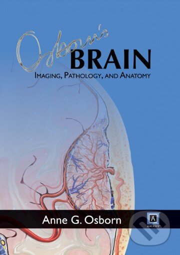Levně Osborn's Brain: Imaging, Pathology, and Anatomy - Anne G. Osborn - kniha z kategorie Odborné a náučné