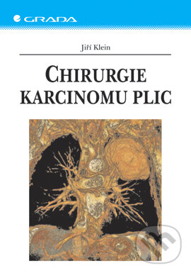 Chirurgie karcinomu plic - Jiří Klein, Grada, 2006