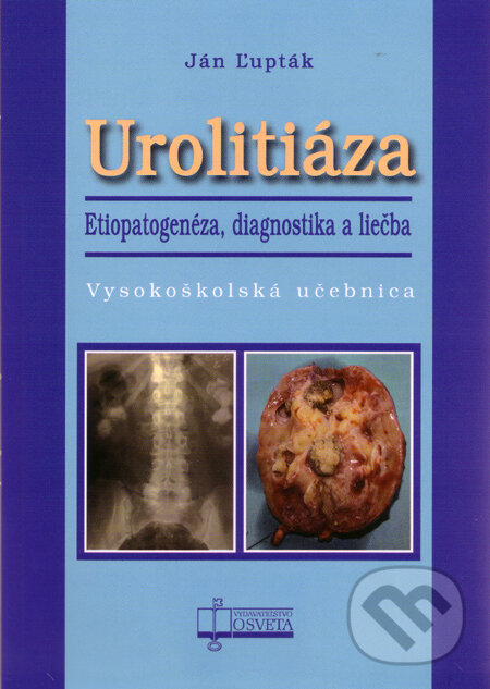 Levně Urolitiáza (Etiopatogenéza, diagnostika a liečba) - Ján Ľupták - kniha z kategorie Urológia