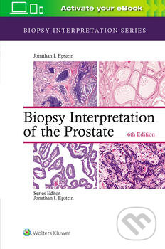Levně Biopsy Interpretation of the Prostate - Jonathan I. Epstein - kniha z kategorie Medicína