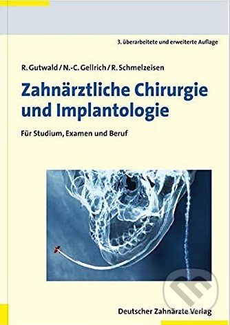 Levně Zahnärztliche Chirurgie und Implantologie (Für Studium, Examen und Beruf) - kniha z kategorie Medicína