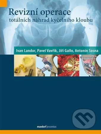 Levně Revizní operace totálních náhrad kyčelního kloubu - Ivan Landor a kolektív - kniha z kategorie Všeobecná chirurgia