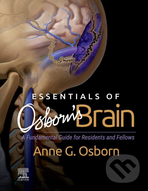 Levně Essentials of Osborn's Brain (A Fundamental Guide for Residents and Fellows) - kniha z kategorie Medicína