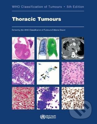 Levně WHO Classification of Tumours: Thoracic Tumours (5th Edition) - kniha z kategorie Medicína
