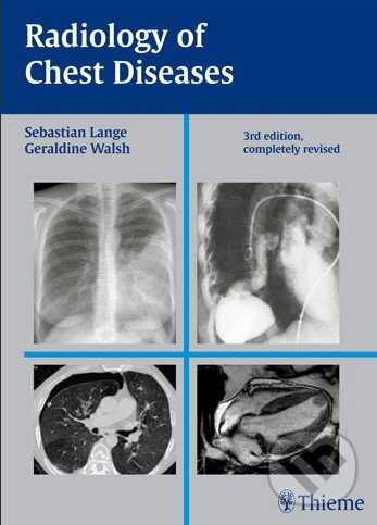Levně Radiology of Chest Diseases - Sebastian Lange - kniha z kategorie Medicína