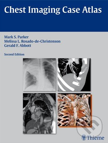 Levně Chest Imaging Case Atlas - Mark S. Parker - kniha z kategorie Odborné a náučné