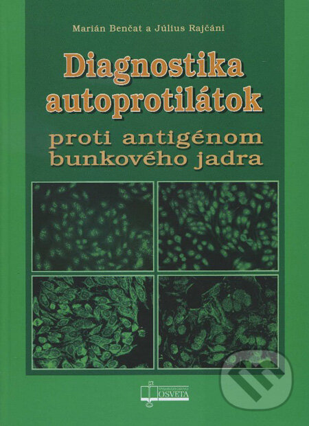 Levně Diagnostika autoprotilátok (Proti antigénom bunkového jadra) - kniha z kategorie Imunológia, virológia a epidemiológia