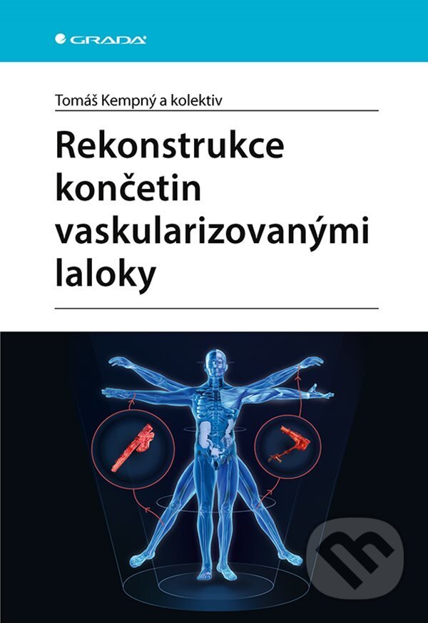 E-kniha: Rekonstrukce končetin vaskularizovanými laloky (Tomáš Kempný). Grada, 2021