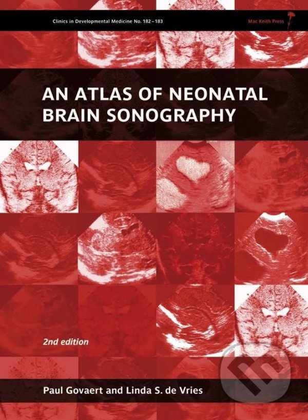 Levně An Atlas of Neonatal Brain Sonography - Paul Govaert, Linda S. de Vries - kniha z kategorie Medicína