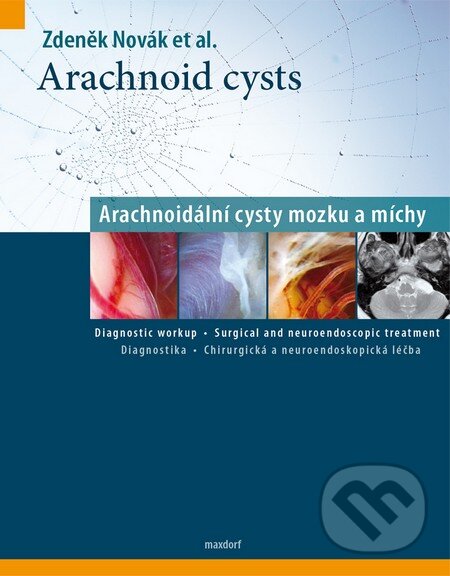 Levně Arachnoid cysts (Arachnoidální cysty mozku a míchy) - kniha z kategorie Neurológia