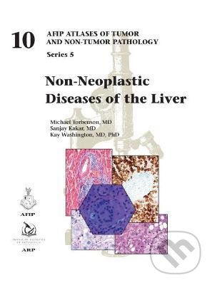 Levně Non-Neoplastic Diseases of the Liver - Michael Torbenson, Sanjay Kakar, Kay Washington - kniha z kategorie Medicína