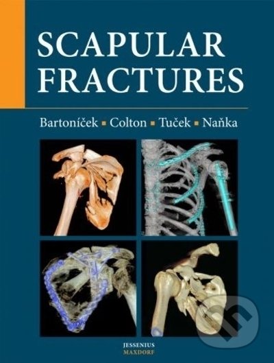 Levně Scapular fractures - Jan Bartoníček, Michal Tuček, Ondřej Naňka - kniha z kategorie Medicína