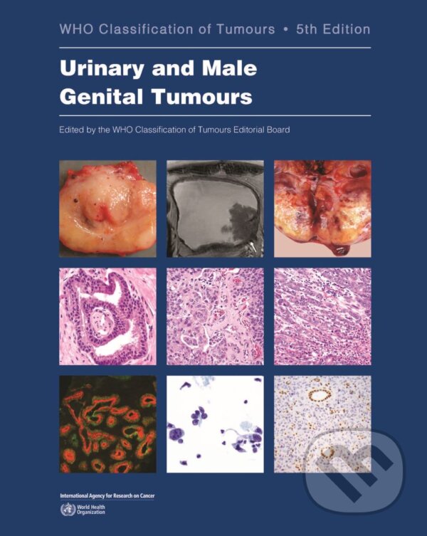 Levně Urinary and Male Genital Tumours (Who Classification of Tumours (5th Edition, Volume 8)) - kniha z kategorie Medicína