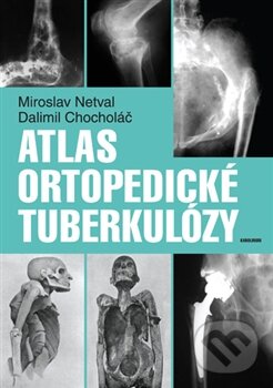 Levně Atlas ortopedické tuberkulózy - Dalimil Chocholáč, Miroslav Netval - kniha z kategorie Medicína