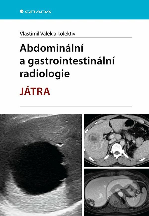 Levně Abdominální a gastrointestinální radiologie (Játra) - kniha z kategorie Vysoké školy