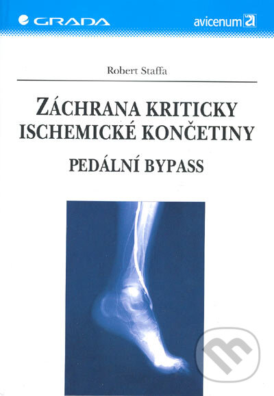 Kniha: Záchrana kriticky ischemické končetiny (Robert Staffa). Grada, 2005
