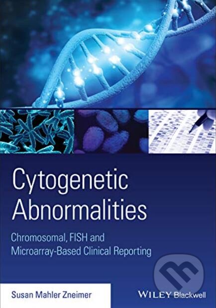 Levně Cytogenetic Abnormalities (Chromosomal, FISH, and Microarray-Based Clinical Reporting and Interpretation of Result) - kniha z kategorie Mikrobiológia…